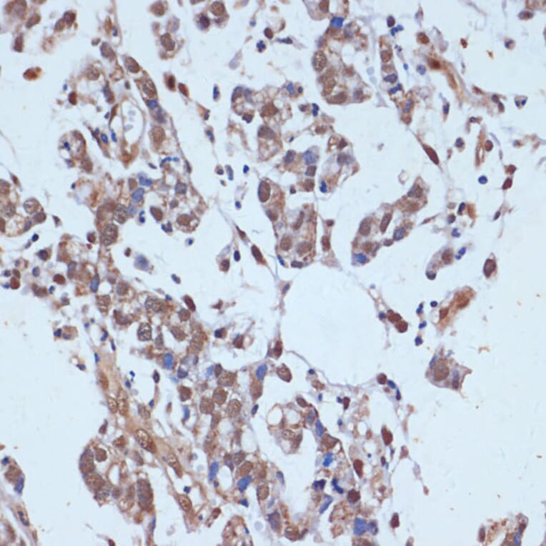 Immunohistochemistry - Anti-53BP2/ASPP2/BBP Antibody (A14921) - Antibodies.com