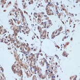 Immunohistochemistry - Anti-53BP2/ASPP2/BBP Antibody (A14921) - Antibodies.com