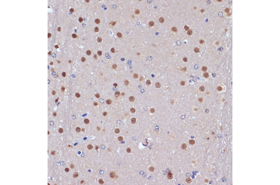 Immunohistochemistry - Anti-53BP2/ASPP2/BBP Antibody (A14921) - Antibodies.com