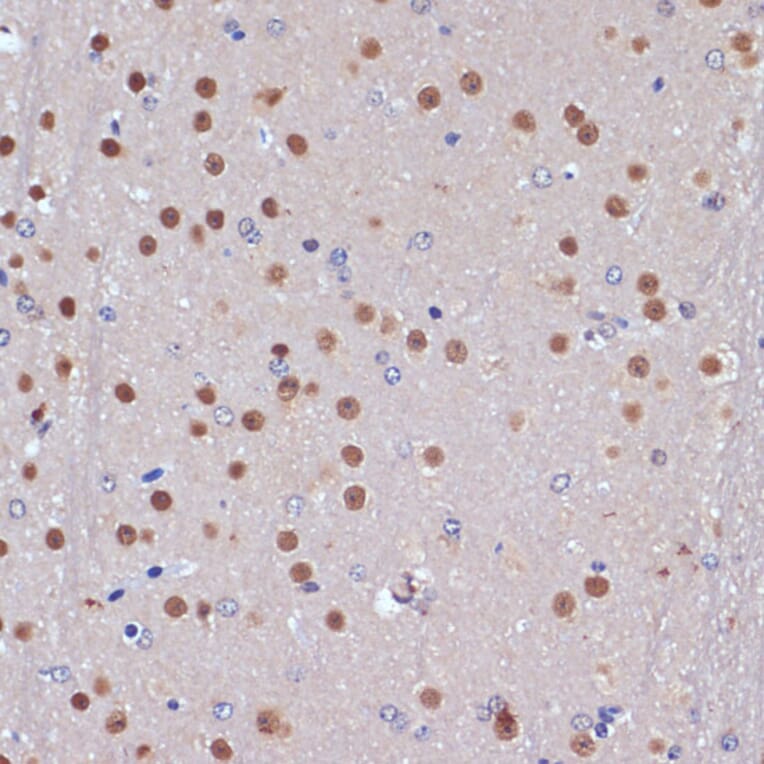 Immunohistochemistry - Anti-53BP2/ASPP2/BBP Antibody (A14921) - Antibodies.com