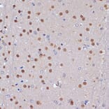 Immunohistochemistry - Anti-53BP2/ASPP2/BBP Antibody (A14921) - Antibodies.com