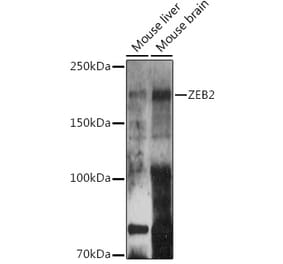 Western Blot - Anti-ZEB2 Antibody (A14922) - Antibodies.com