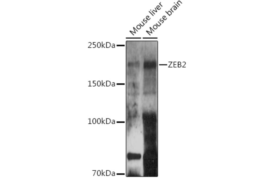 Western Blot - Anti-ZEB2 Antibody (A14922) - Antibodies.com