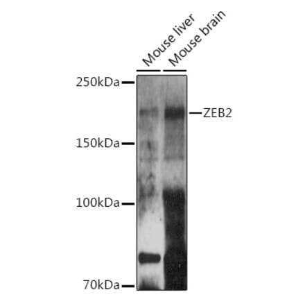 Western Blot - Anti-ZEB2 Antibody (A14922) - Antibodies.com