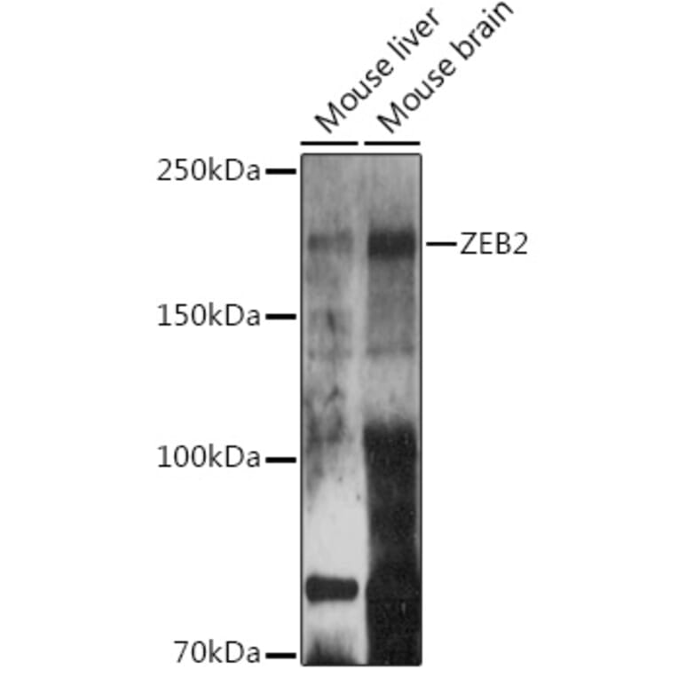 Western Blot - Anti-ZEB2 Antibody (A14922) - Antibodies.com
