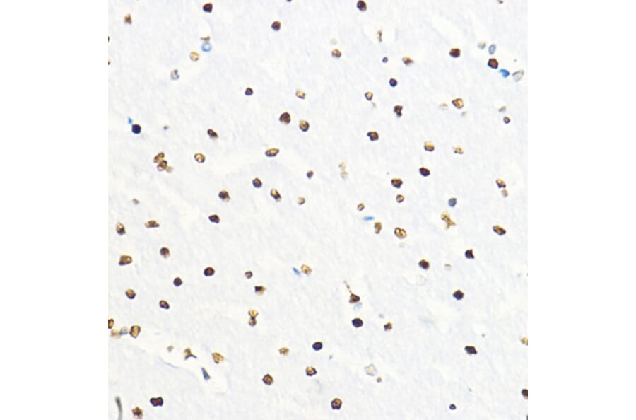 Immunohistochemistry - Anti-ZEB2 Antibody (A14922) - Antibodies.com
