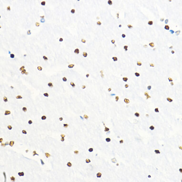 Immunohistochemistry - Anti-ZEB2 Antibody (A14922) - Antibodies.com