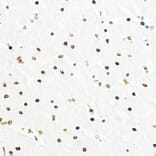 Immunohistochemistry - Anti-ZEB2 Antibody (A14922) - Antibodies.com