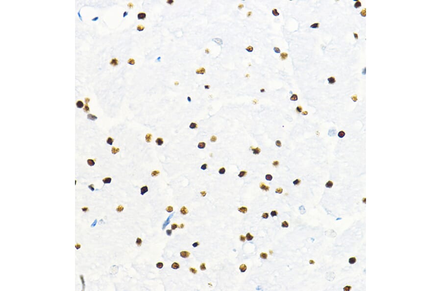 Immunohistochemistry - Anti-ZEB2 Antibody (A14922) - Antibodies.com