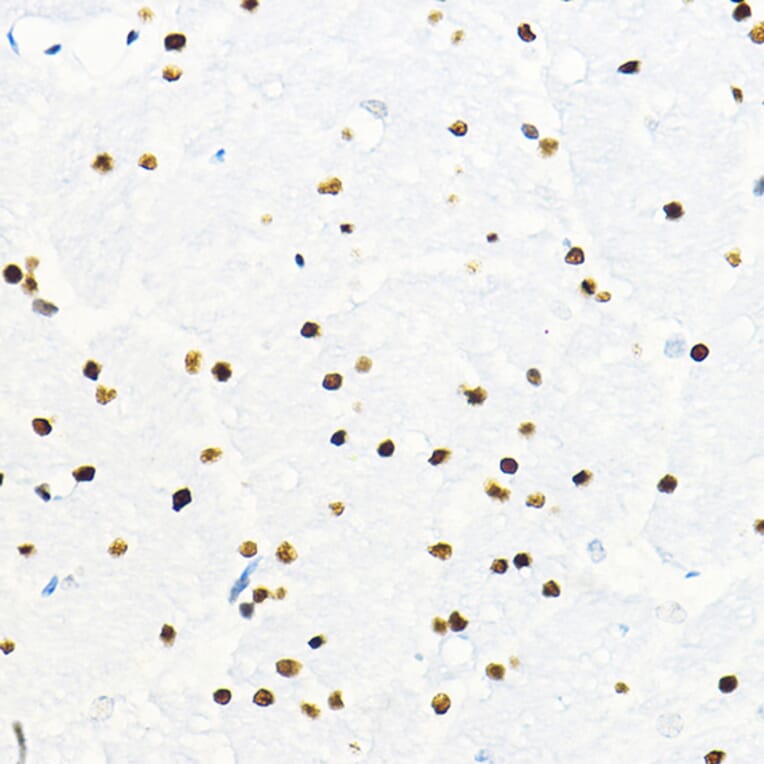 Immunohistochemistry - Anti-ZEB2 Antibody (A14922) - Antibodies.com