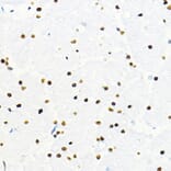 Immunohistochemistry - Anti-ZEB2 Antibody (A14922) - Antibodies.com
