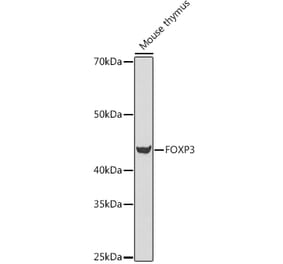 Western Blot - Anti-FOXP3 Antibody (A14923) - Antibodies.com