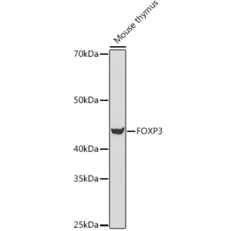 Western Blot - Anti-FOXP3 Antibody (A14923) - Antibodies.com