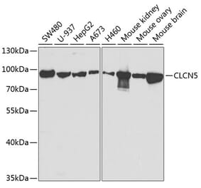 Western Blot - Anti-ClC-5 Antibody (A14924) - Antibodies.com
