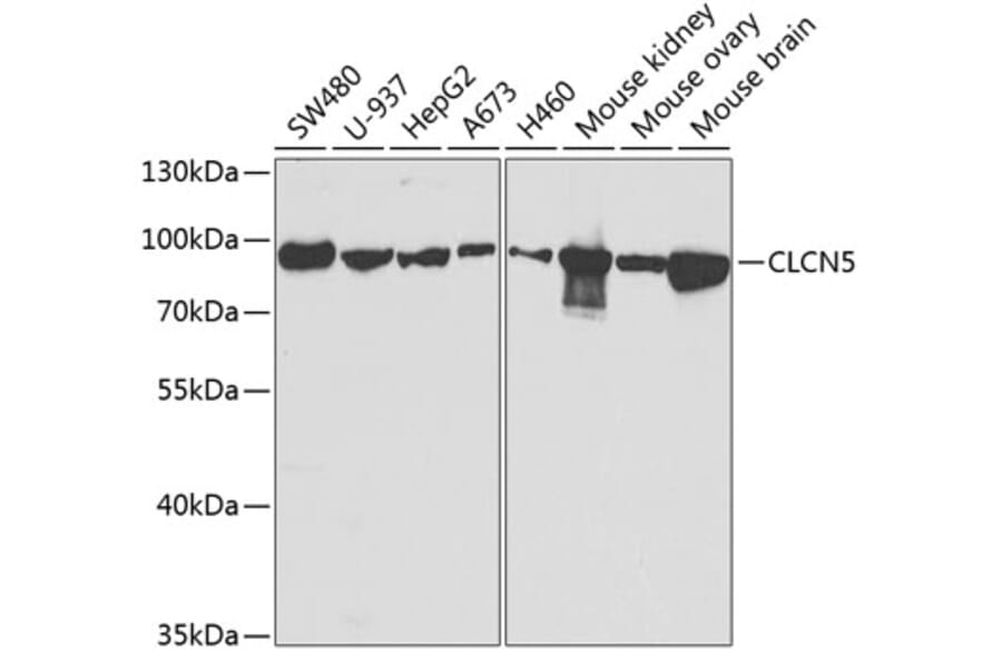 Western Blot - Anti-ClC-5 Antibody (A14924) - Antibodies.com