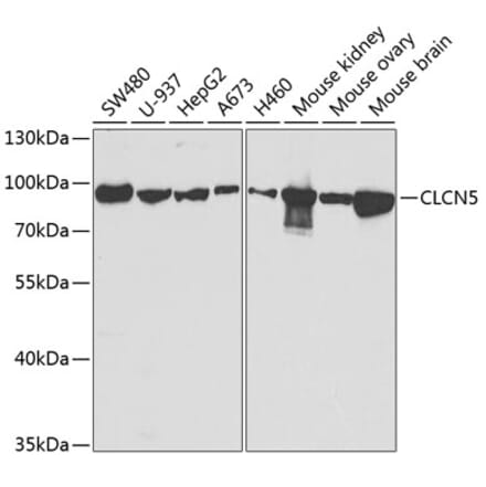 Western Blot - Anti-ClC-5 Antibody (A14924) - Antibodies.com