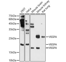 Western Blot - Anti-VEGFA Antibody (A14925) - Antibodies.com