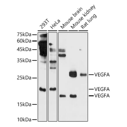 Western Blot - Anti-VEGFA Antibody (A14925) - Antibodies.com