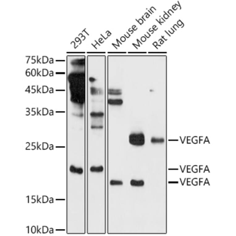 Western Blot - Anti-VEGFA Antibody (A14925) - Antibodies.com