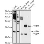 Western Blot - Anti-VEGFA Antibody (A14925) - Antibodies.com