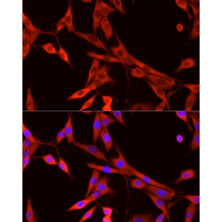 Immunofluorescence - Anti-VEGFA Antibody (A14925) - Antibodies.com