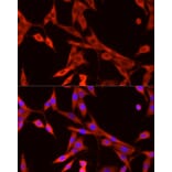 Immunofluorescence - Anti-VEGFA Antibody (A14925) - Antibodies.com