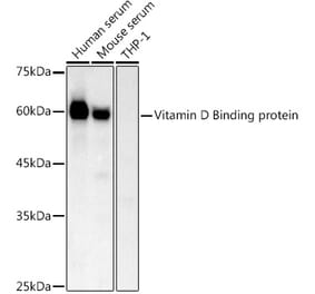 Western Blot - Anti-Vitamin D Binding protein Antibody (A14926) - Antibodies.com