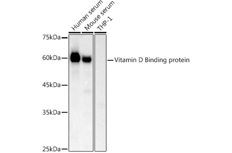 Western Blot - Anti-Vitamin D Binding protein Antibody (A14926) - Antibodies.com