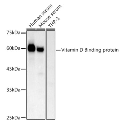 Western Blot - Anti-Vitamin D Binding protein Antibody (A14926) - Antibodies.com