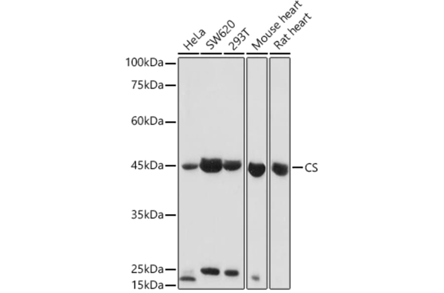 Western Blot - Anti-Citrate synthetase Antibody (A14927) - Antibodies.com