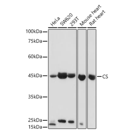 Western Blot - Anti-Citrate synthetase Antibody (A14927) - Antibodies.com