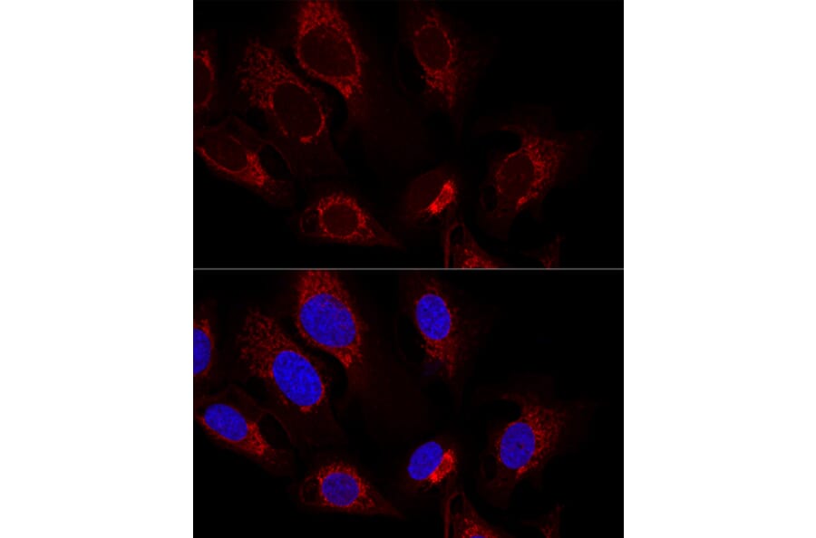 Immunofluorescence - Anti-Citrate synthetase Antibody (A14927) - Antibodies.com
