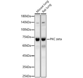Western Blot - Anti-PKC zeta Antibody (A14928) - Antibodies.com