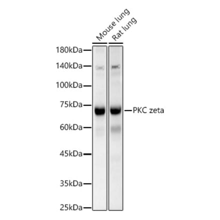 Western Blot - Anti-PKC zeta Antibody (A14928) - Antibodies.com