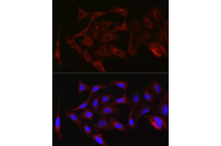 Immunofluorescence - Anti-PKC zeta Antibody (A14928) - Antibodies.com