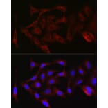 Immunofluorescence - Anti-PKC zeta Antibody (A14928) - Antibodies.com