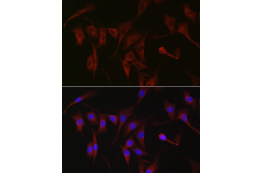 Immunofluorescence - Anti-PKC zeta Antibody (A14928) - Antibodies.com