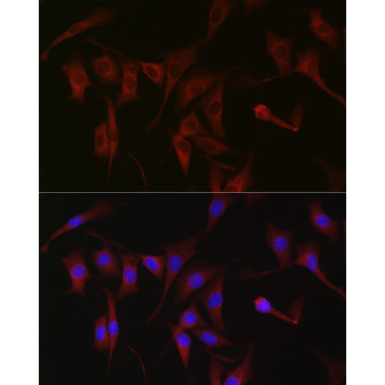 Immunofluorescence - Anti-PKC zeta Antibody (A14928) - Antibodies.com