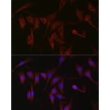 Immunofluorescence - Anti-PKC zeta Antibody (A14928) - Antibodies.com