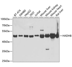 Western Blot - Anti-HADHB Antibody (A14930) - Antibodies.com