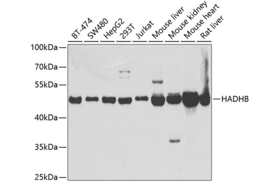 Western Blot - Anti-HADHB Antibody (A5716) - Antibodies.com