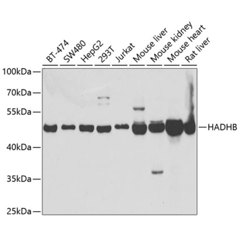 Western Blot - Anti-HADHB Antibody (A5716) - Antibodies.com