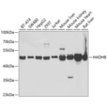 Western Blot - Anti-HADHB Antibody (A5716) - Antibodies.com