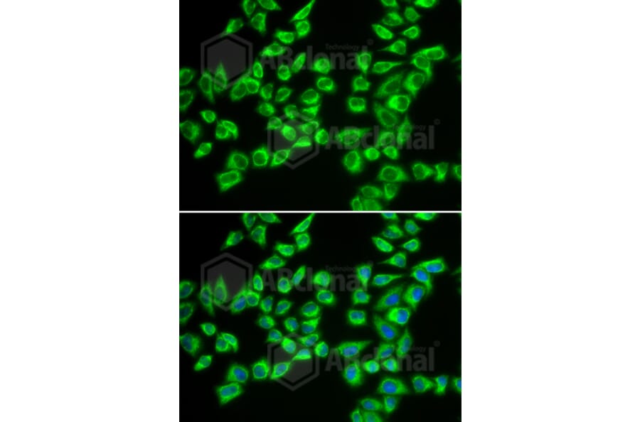 Immunofluorescence - Anti-HADHB Antibody (A5716) - Antibodies.com
