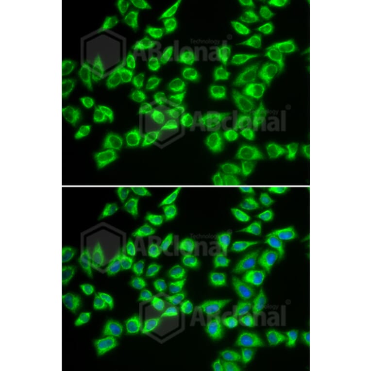 Immunofluorescence - Anti-HADHB Antibody (A5716) - Antibodies.com