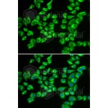 Immunofluorescence - Anti-HADHB Antibody (A5716) - Antibodies.com
