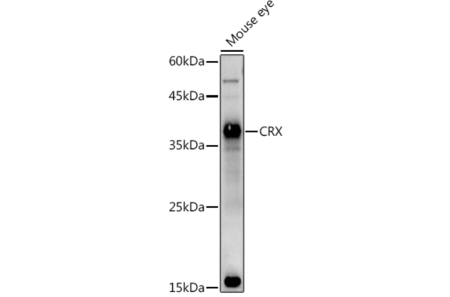 Western Blot - Anti-CRX Antibody (A14932) - Antibodies.com