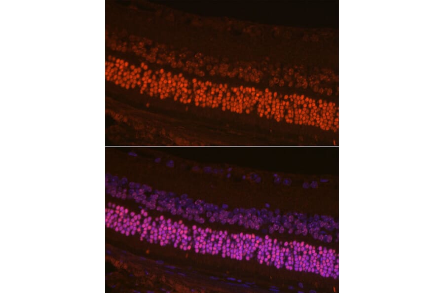 Immunofluorescence - Anti-CRX Antibody (A14932) - Antibodies.com
