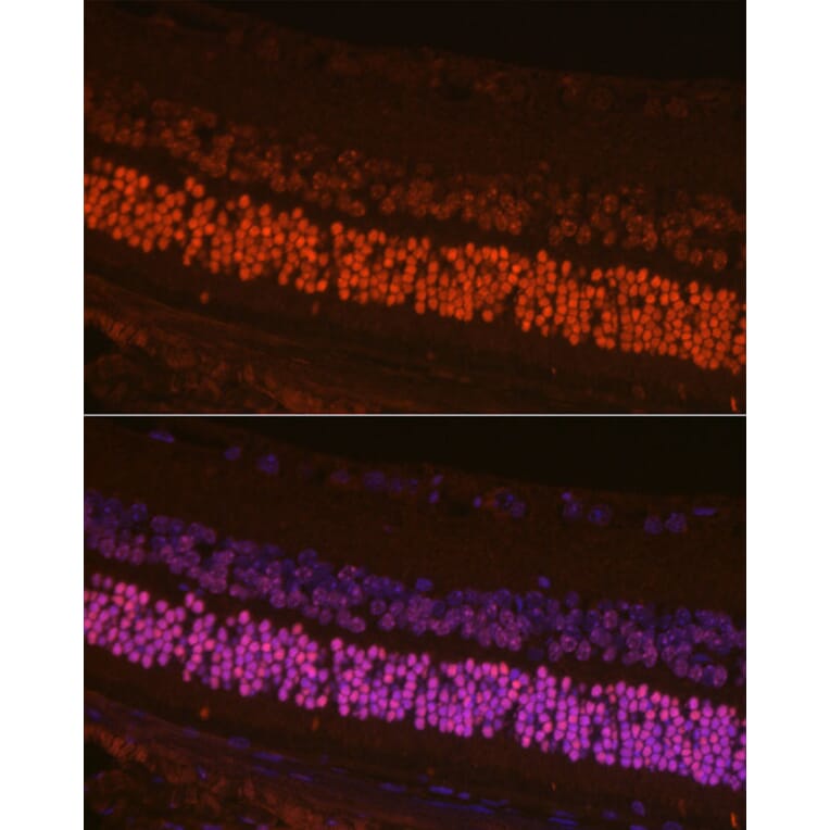 Immunofluorescence - Anti-CRX Antibody (A14932) - Antibodies.com