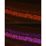 Immunofluorescence - Anti-CRX Antibody (A14932) - Antibodies.com